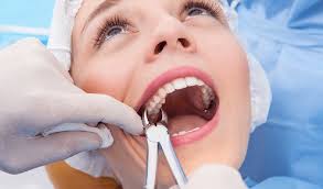 tooth extraction